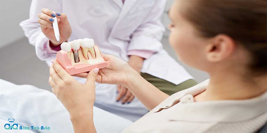 ایمپلنت‌های تیتانیومی معمولاً برای جایگزینی دندان‌های آسیب‌دیده یا ازدست‌رفته استفاده می‌شوند/شرکت آراز طب آسیا