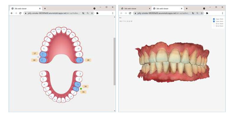 اسکنر Runyes اسکنری برای دیجیتالی کردن دندان پزشکی